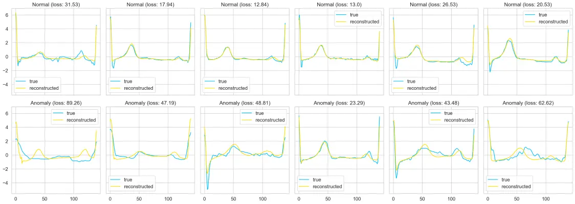 Autoencoder GRU para ECG